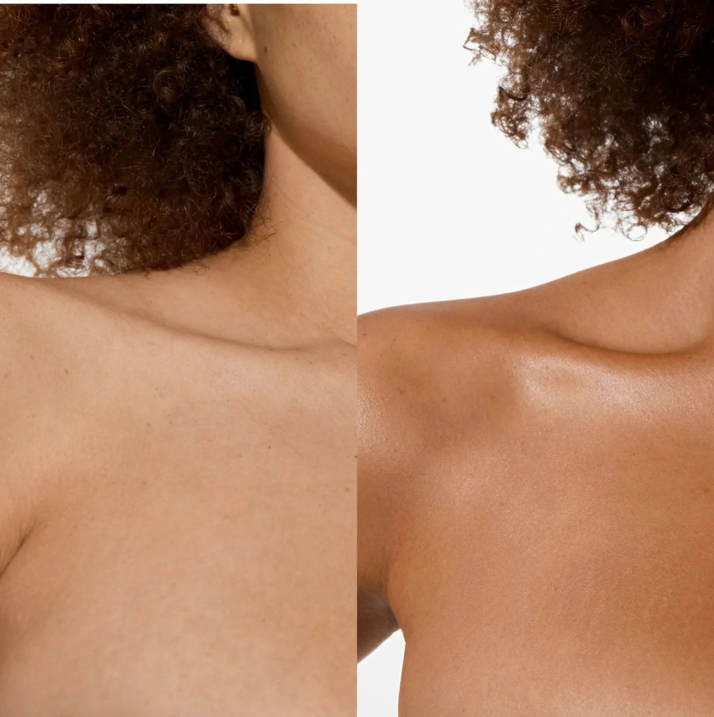 Original Body Blur Touch & Glow Skin & Laser Clinic