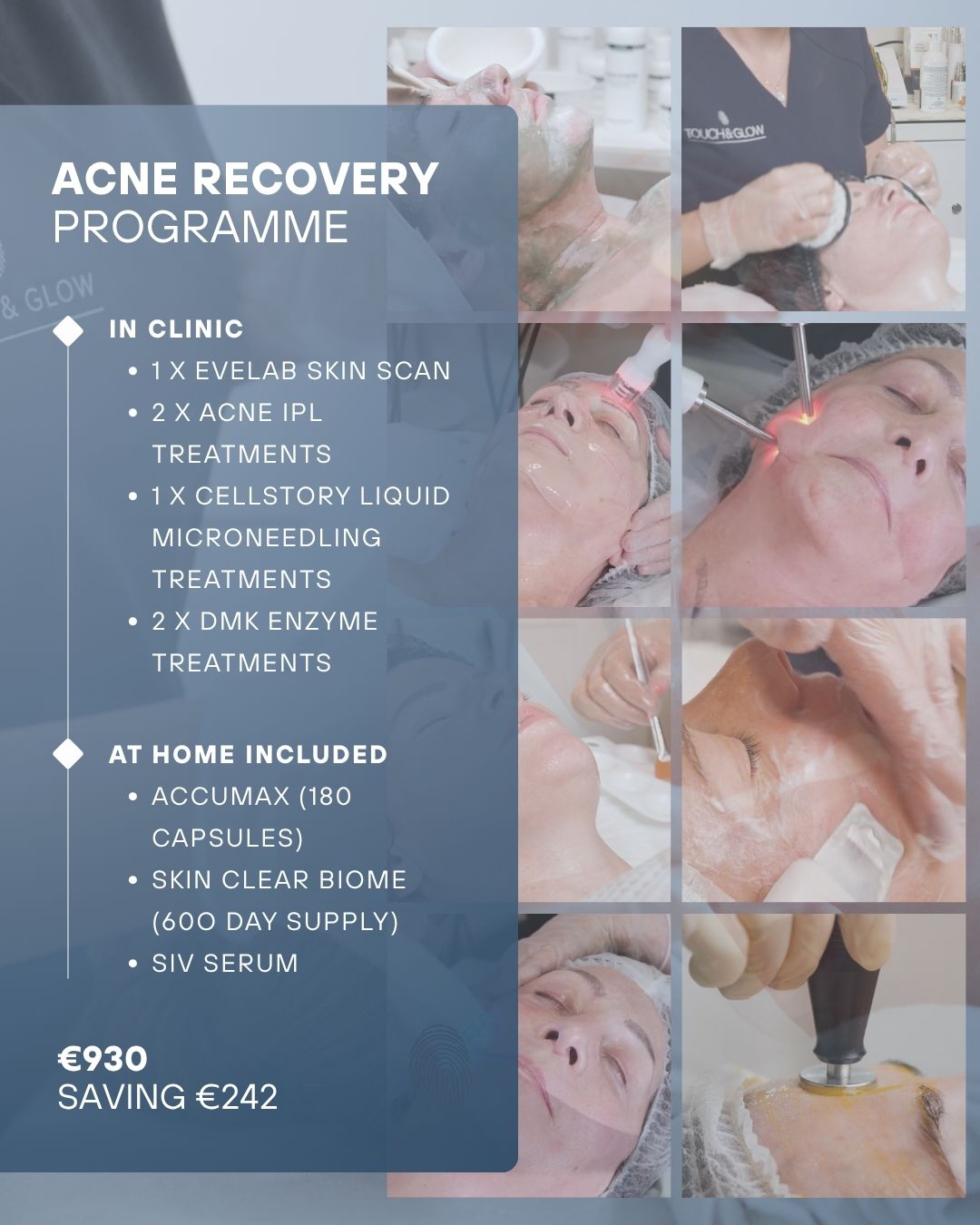ACNE RECOVERY PROGRAMME