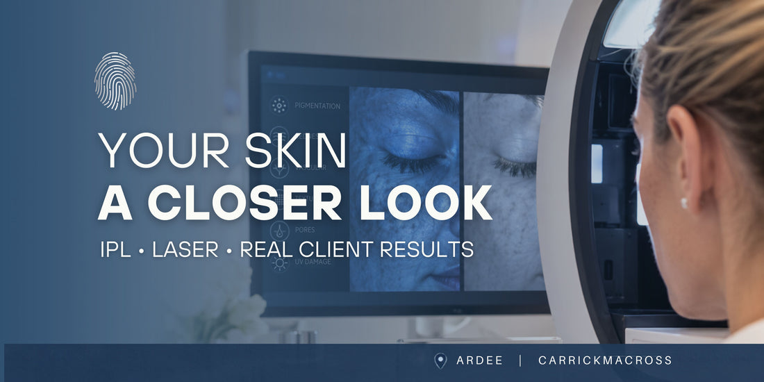 Touch & Glow IPL and laser skin treatments blog cover featuring skin analysis imagery and information about pigmentation, facial veins and real client results.