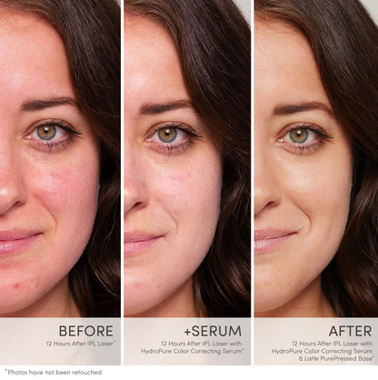 HydroPure™ Color Correcting Serum