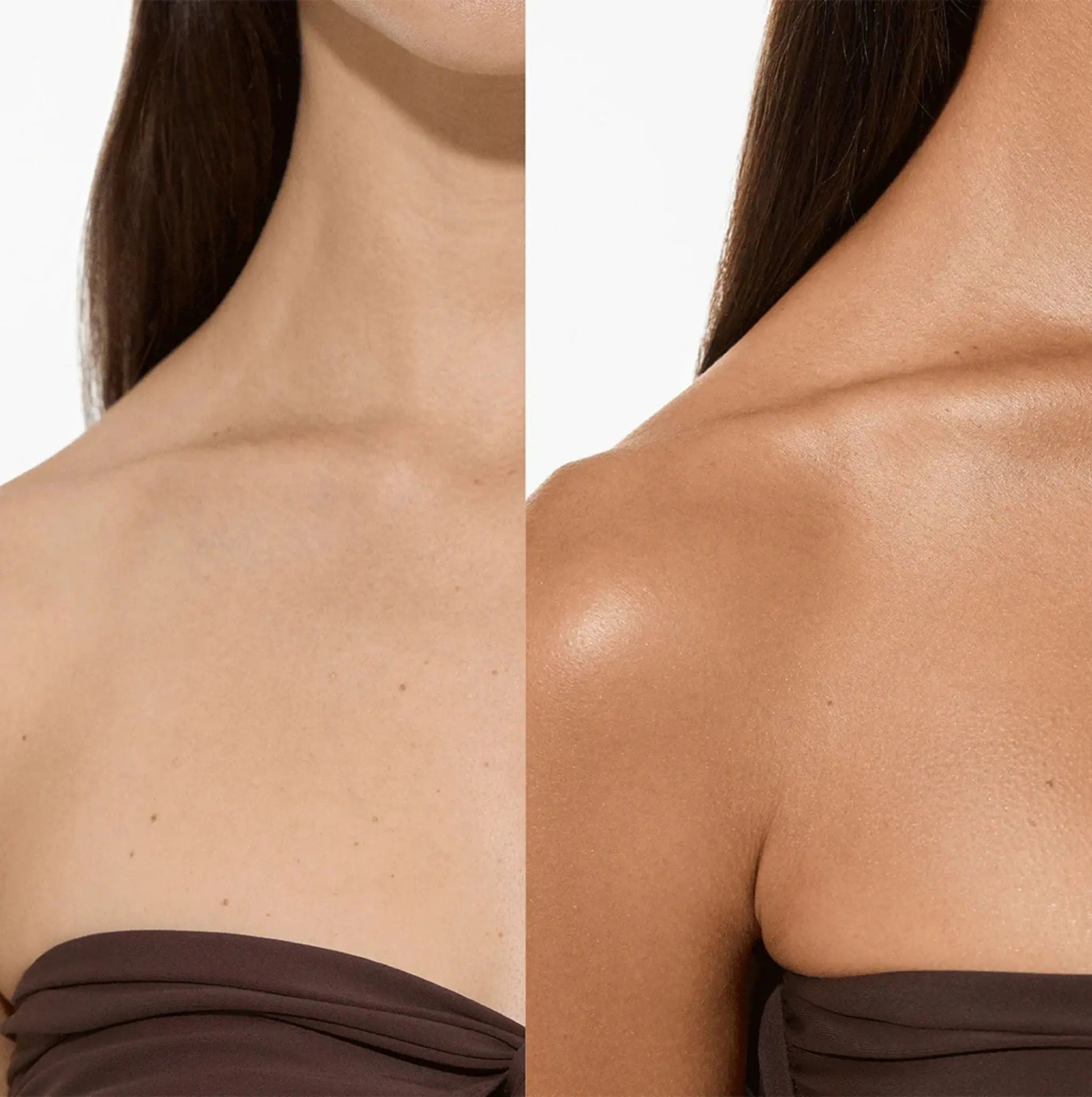 Original Body Blur Touch & Glow Skin & Laser Clinic