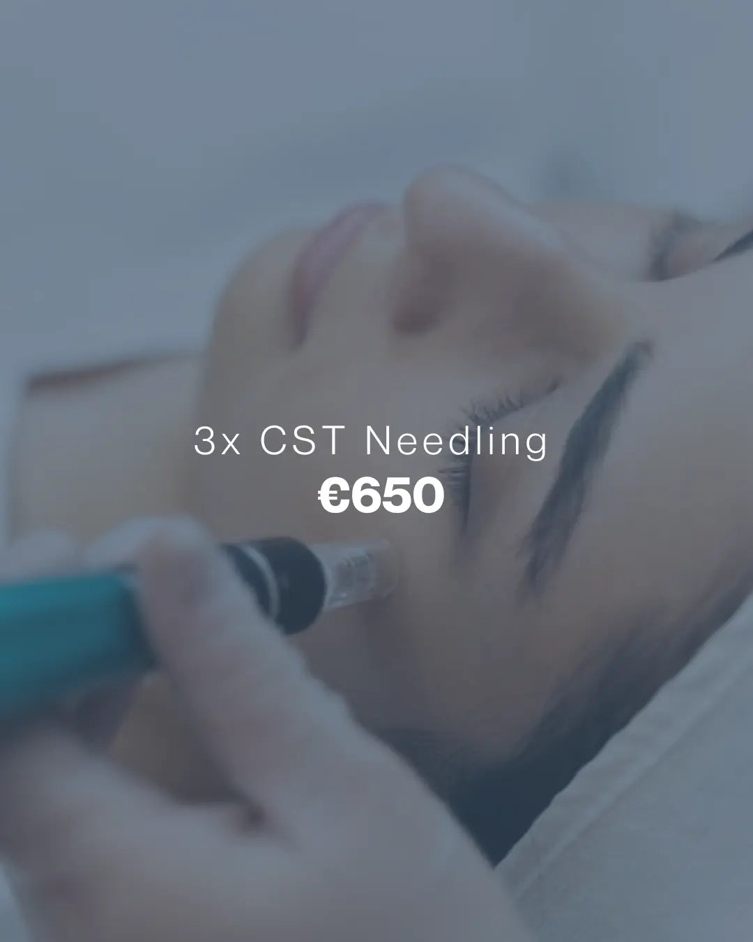 x3 CST NEEDLING Touch & Glow Skin & Laser Clinic