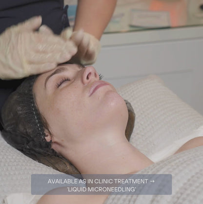Miracletox Perfection TOX Ampoule (4 x Treatments)