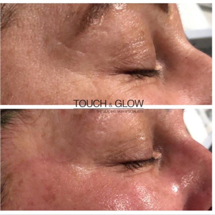 DMK Skincare - Touch & Glow Skin And Laser Clinic