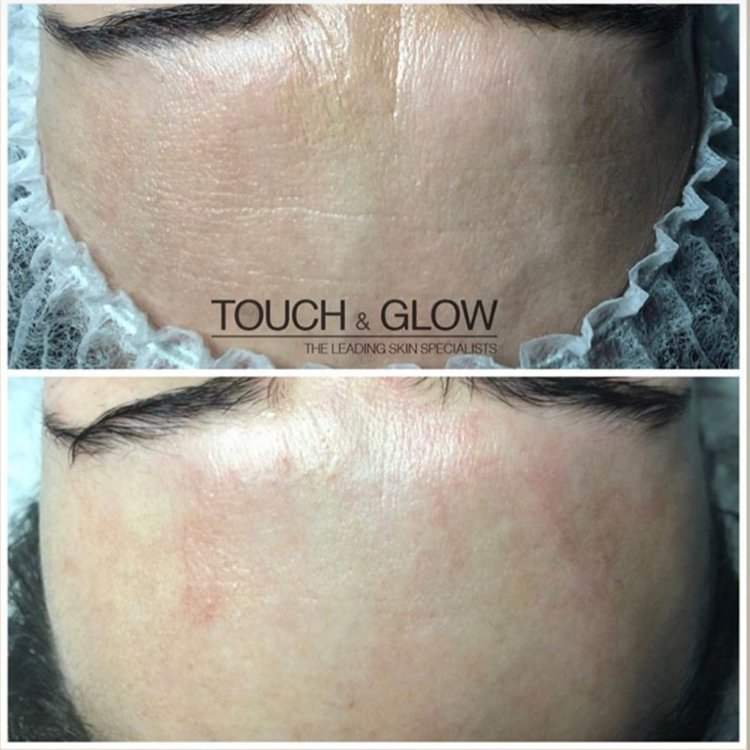 DMK Skincare - Touch & Glow Skin And Laser Clinic