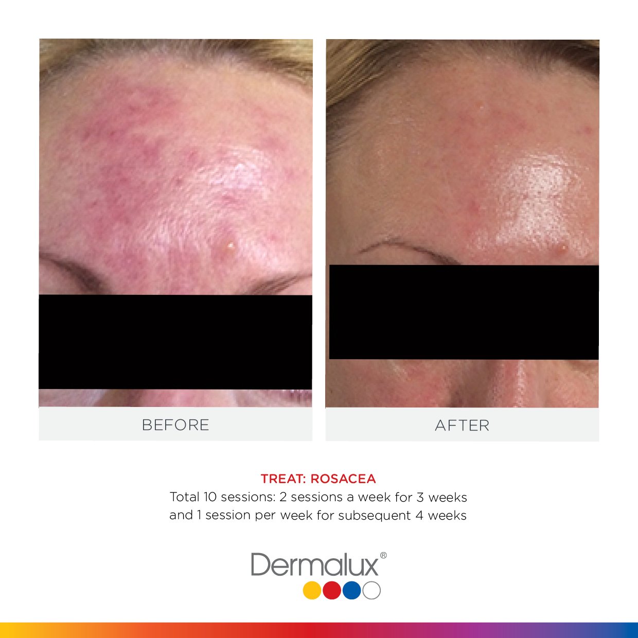 Dermalux - Touch & Glow Skin And Laser Clinic