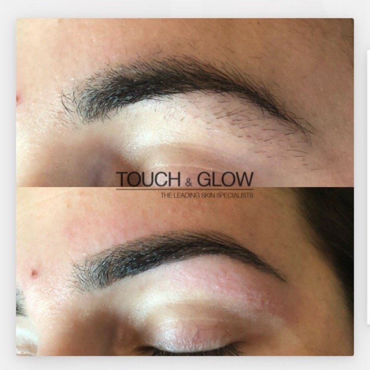 HD Brows - Touch & Glow Skin And Laser Clinic