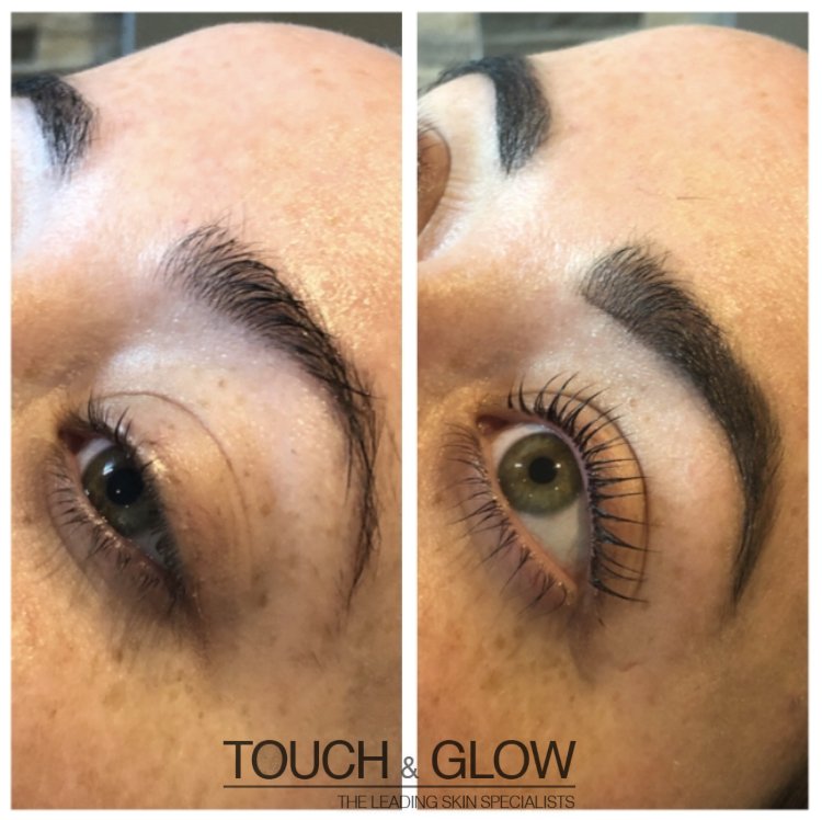 HD Brows - Touch & Glow Skin And Laser Clinic