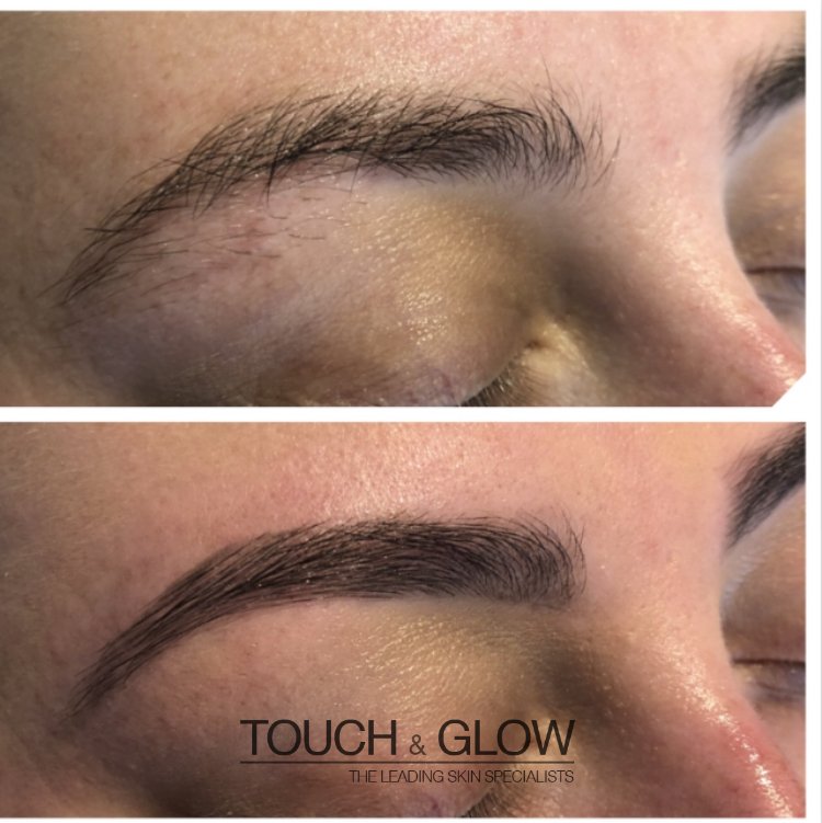 HD Brows - Touch & Glow Skin And Laser Clinic