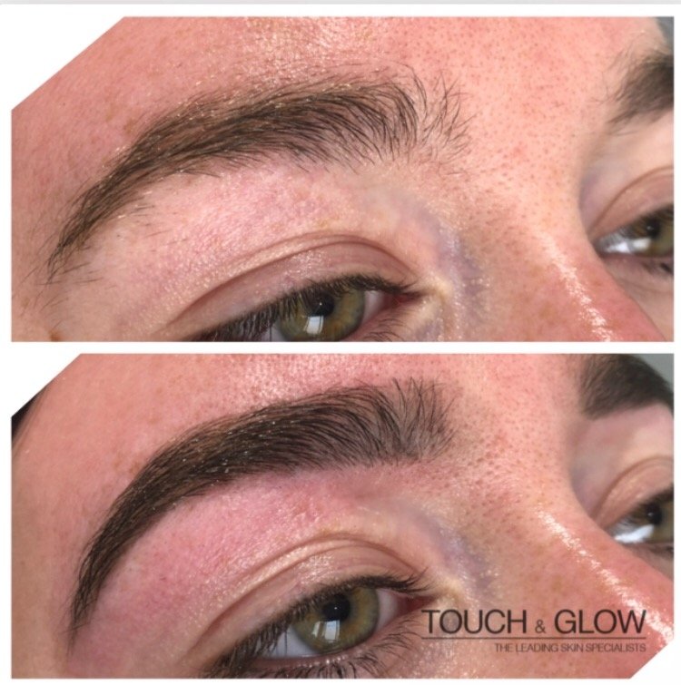 HD Brows - Touch & Glow Skin And Laser Clinic