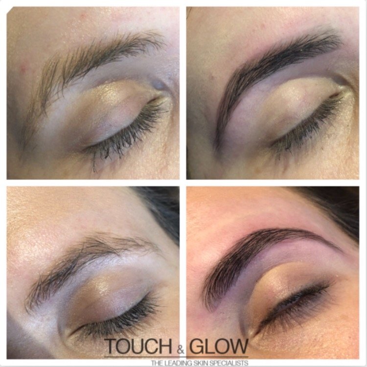 HD Brows - Touch & Glow Skin And Laser Clinic