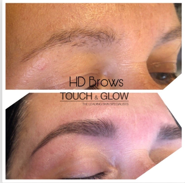 HD Brows - Touch & Glow Skin And Laser Clinic