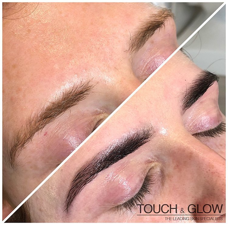 HD Brows - Touch & Glow Skin And Laser Clinic