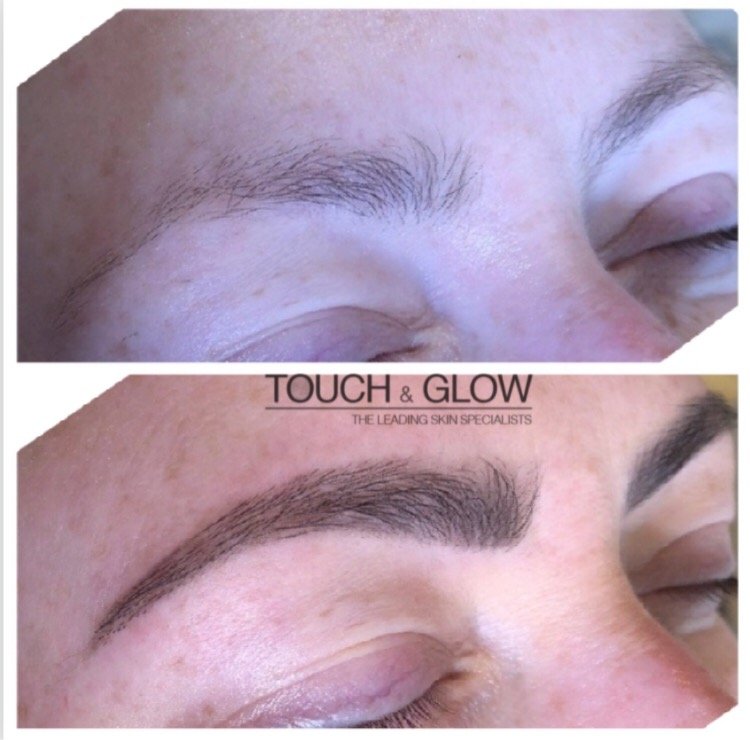 HD Brows - Touch & Glow Skin And Laser Clinic