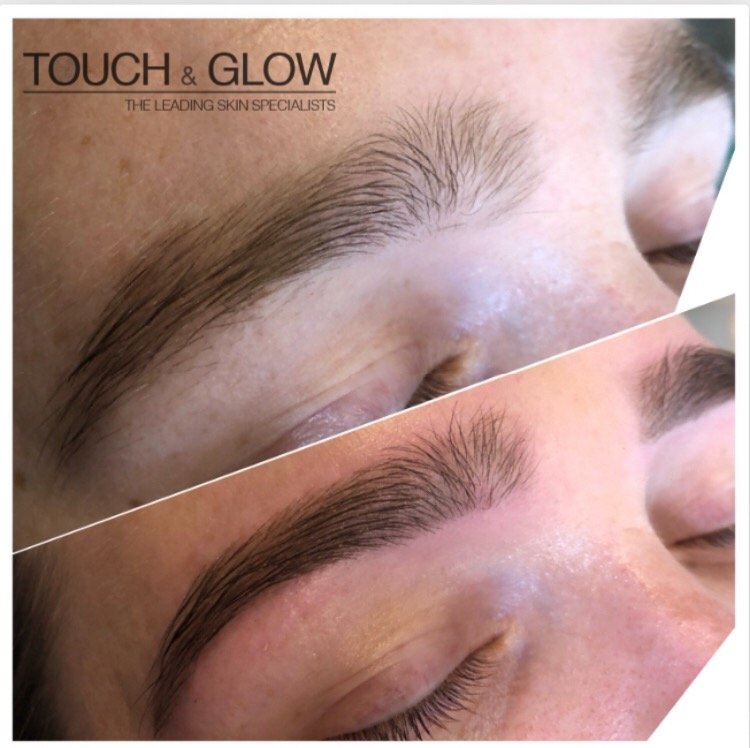 HD Brows - Touch & Glow Skin And Laser Clinic