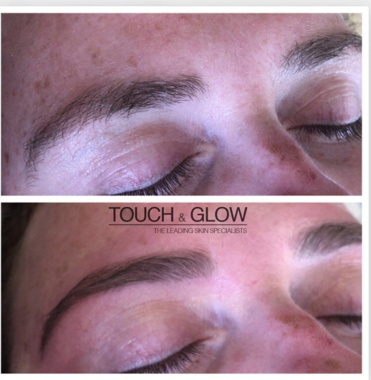 HD Brows - Touch & Glow Skin And Laser Clinic