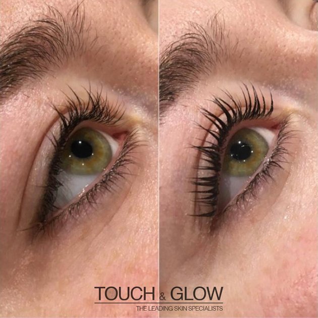 LVL Lashes - Touch & Glow Skin And Laser Clinic