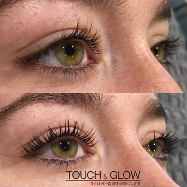 LVL Lashes - - Touch & Glow Skin And Laser Clinic