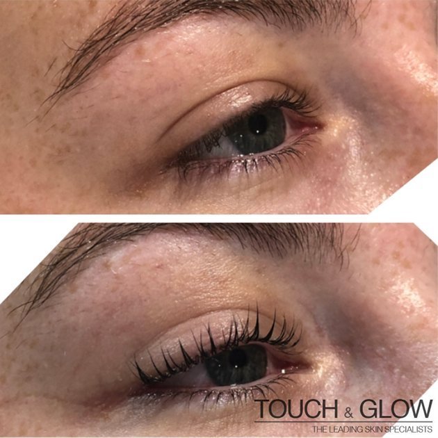 LVL Lashes - - Touch & Glow Skin And Laser Clinic