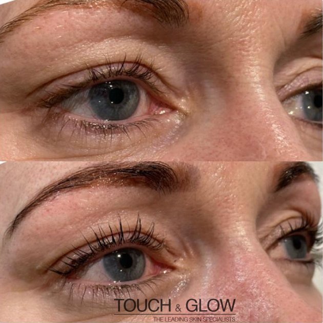 LVL Lashes - - Touch & Glow Skin And Laser Clinic