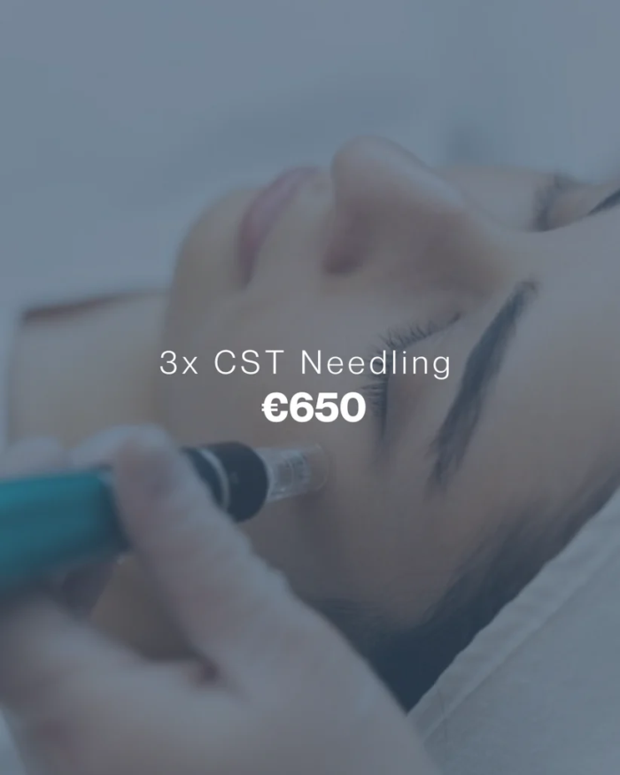 x3 CST NEEDLING